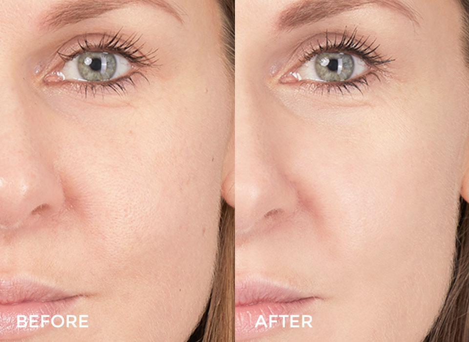 07Modeling-Mask-Facial_Vitamin_CModeling